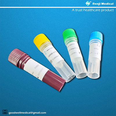 طقم اختبار تفاعل سلسلة البوليميراز ORF1ab شهادة SDS CE