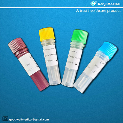 طقم اختبار الحمض النووي لفحص الأسفار ، اختبار RT-PCR لفيروس كورونا الجديد السريع